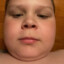 65