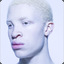 albino negro