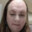 Sphincter grazer