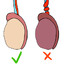 Torsion