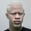 albino IRL