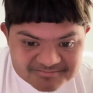 Downs