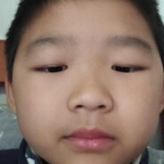 你身上的红斑是蚊子咬