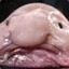 vøllepøllle