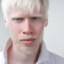 30kg Albino