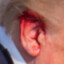 Trump&#039;s Right Ear