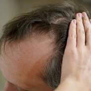 Za kole gami skocze w ogień