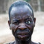 Congolose kidney stone collector