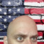 AmericanBaldy