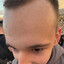 forehead mejster