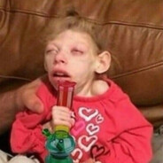 Special Ed kid with herpies