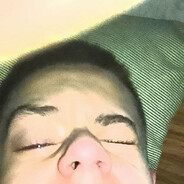 cheelz1