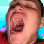 Klemma