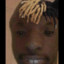 XXEGGSTENTASION