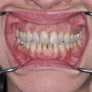 Сватну Адвоката