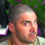 Bald Rizz