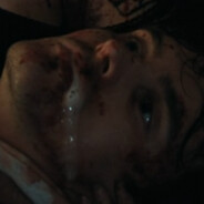Forced Lobotomy Survivor