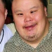 手指残疾的聋哑人