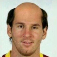 Bald Messi