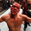 Nate Diaz