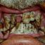 Dentalheld