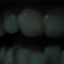 TEETH