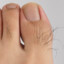 Hairy Toe Knuckle