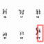 ChromosomeXY