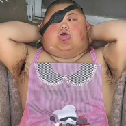 潮湿的阴囊