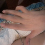 ДИКИЙ ПАЛЕЦЬ