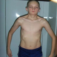 смерть в дрыщите