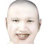 ้