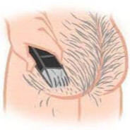 (ง ˙ω˙)ว Suntukan