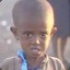 starving african child