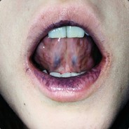 Зіг хайль|FIXCSGO