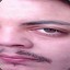 VAC