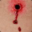 bullet wound