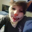 ane