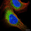 endoplasmic