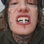 skellmoten