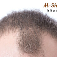 benas raketa - steam id 76561198064545313