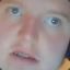 Flatuspluss
