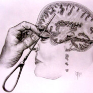 The lobotomy