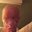 poo