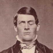 Phineas Gage