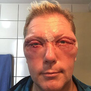 Vesa Keskisen vyönsolki