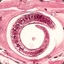 Trichinella spiralis