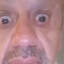 Hervé 2