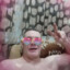 Веселый Фимоз