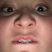 Cetla